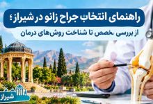 راهنمای انتخاب جراح زانو در شیراز